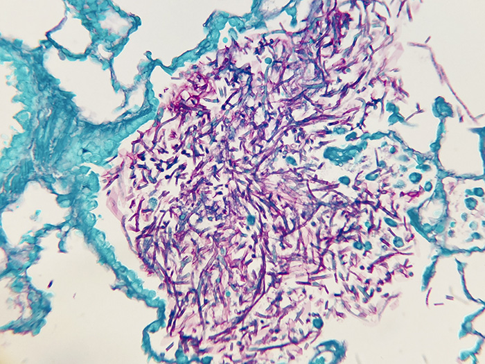 Fungus, PAS, Aspergillus, Artificial Stained Histology Slide