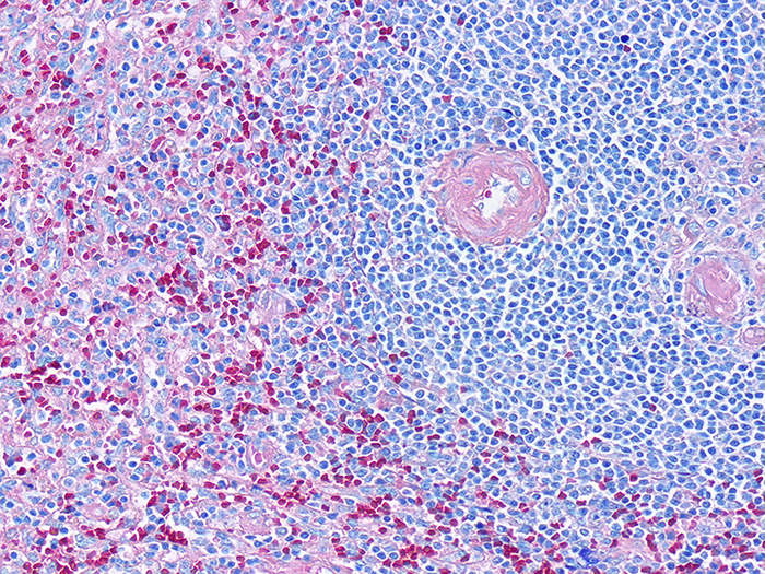 Giemsa Stained Histology Slide