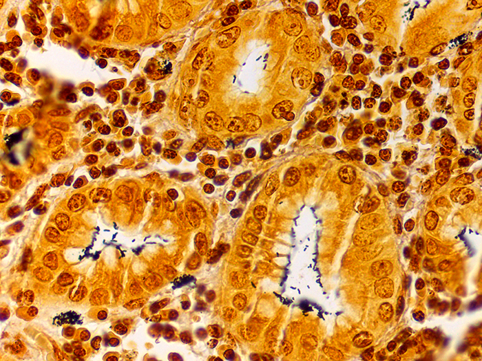 Helicobacter sp., Animal Stained Histology Slide
