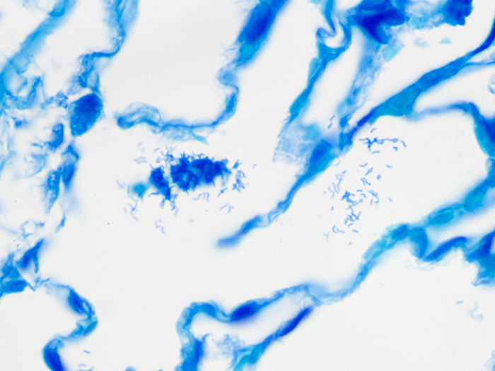 Helicobacter, Artificial Stained Histology Slide