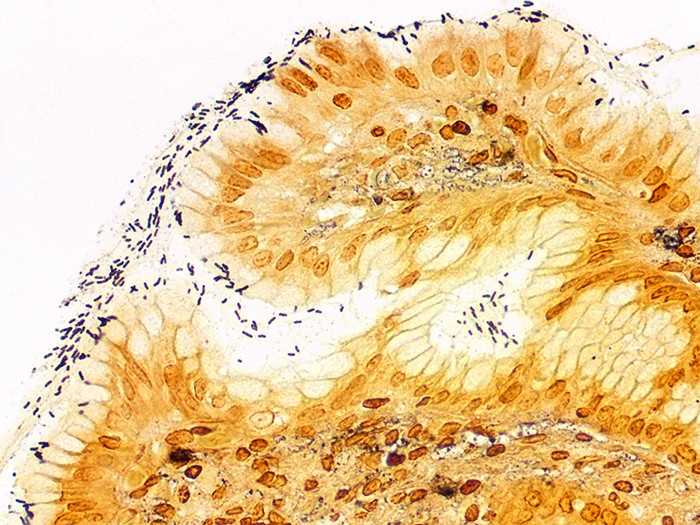 Helicobacter sp. Stained Histology Slide