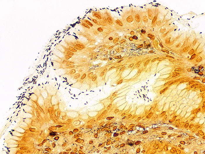 Helicobacter Stained Histology Slide