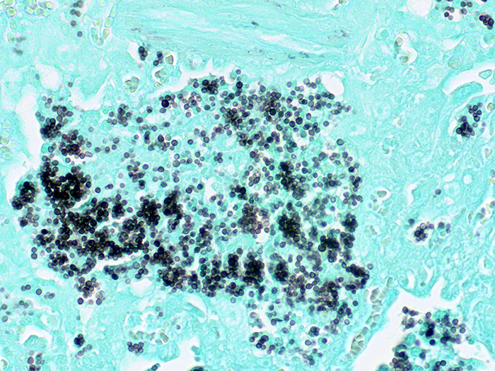 Histoplasma, Animal Stained Histology Slide