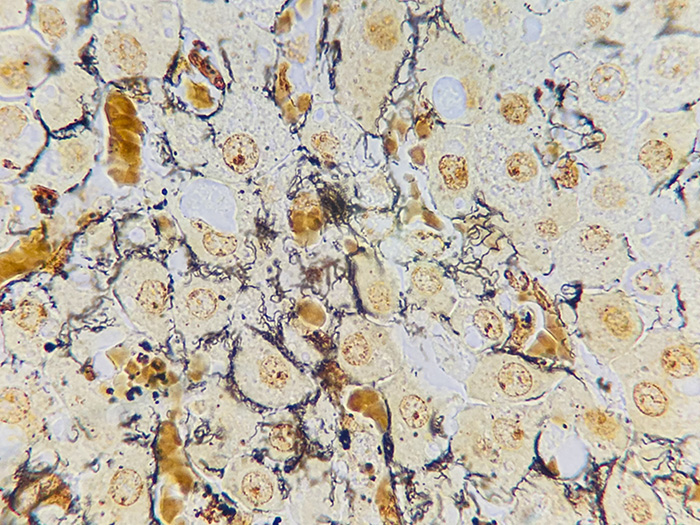 Leptospira sp., Animal Stained Histology Slide
