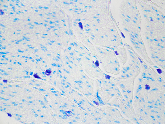 Mast Cell Stained Histology Slide