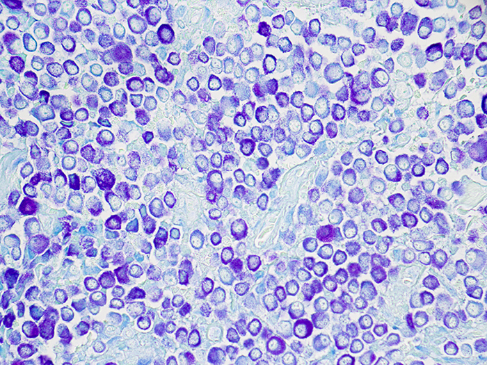 Mast Cell, Animal Stained Histology Slide