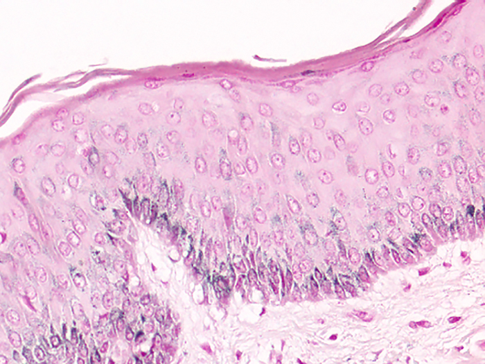 Melanin Stained Histology Slide