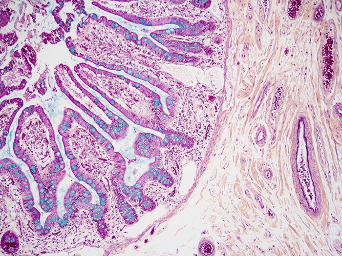 Movat-Russell Pentachrome Stained Histology Slide