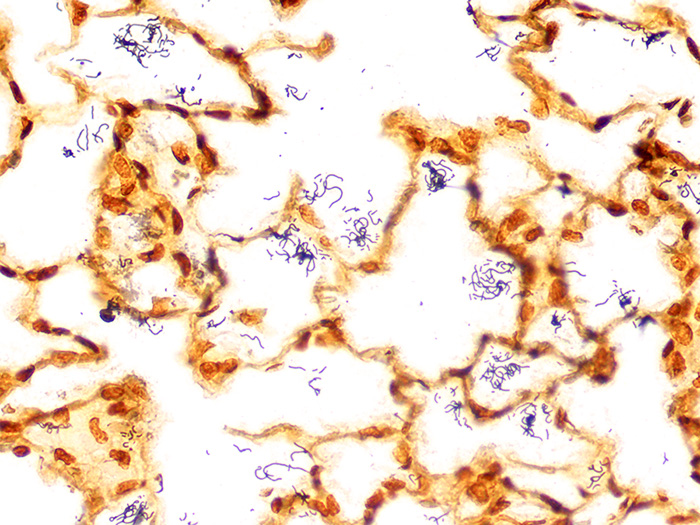 Spirochete, Artificial Stained Histology Slide