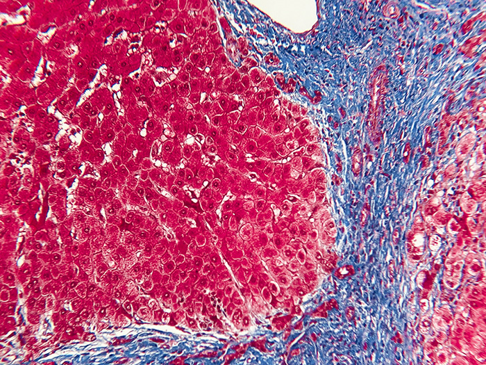 Trichrome, Liver Stained Histology Slide