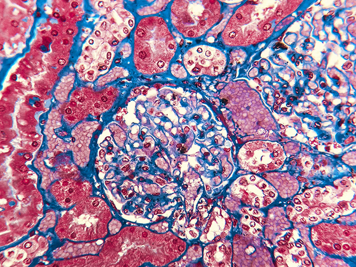 Trichrome, Kidney Stained Histology Slide