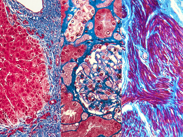 Trichrome, Multi-Tissue Stained Histology Slide