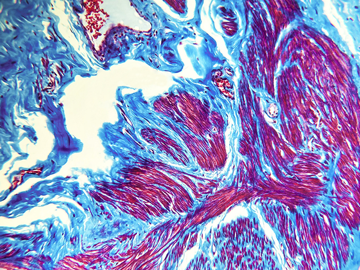 Trichrome, Uterus Stained Histology Slide