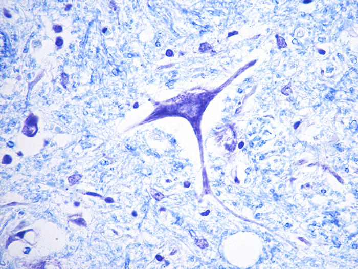 Luxol Fast Blue (LFB) Stained Histology Slide