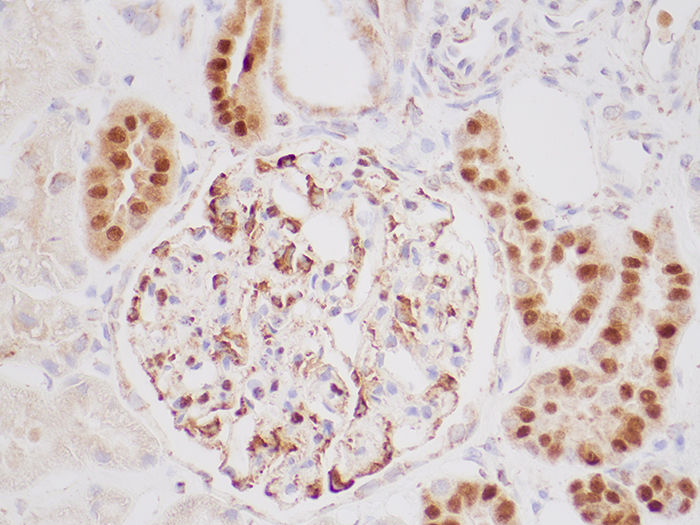 GATA3 Stained Histology Slide