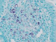 AFB, Kinyoun Stain