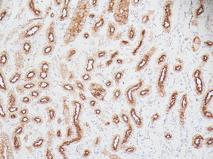 Epithelial Membrane Antigen (EMA) Stained Histology Slide