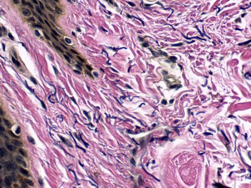 ELASTIC, Skin Control Histology Slides