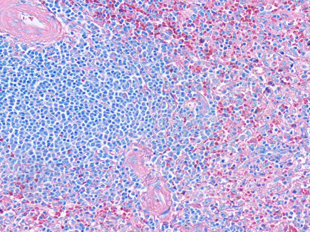 Giemsa May Grunwald Histology Staining Procedure giemsa-may-grunwald-histology-staining-procedure