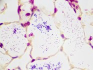 Gram Positive Gram Negative Bacteria Histology Control Slides Artificial Gram Positive Gram Negative Bacteria Histology Control Slides Artificial