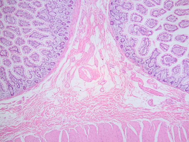 Hematoxylin & Eosin (H&E) Regressive Stain