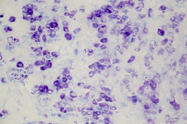 Mast Cell, Toluidine Blue Stain for Histology