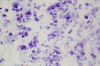Mast Cell Toluidine Blue Stain for Histology
