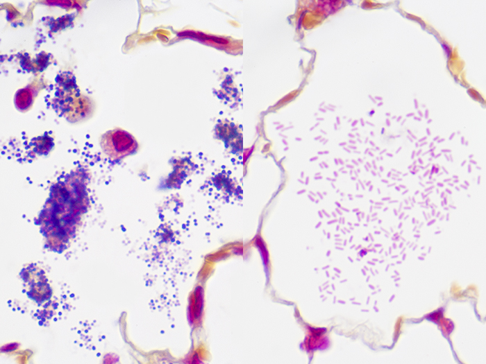 Gram Positive & Gram Negative Bacteria, Artificial Stained Histology Slide