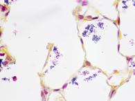 Tartrazine Stain 1.5%, Aqueous