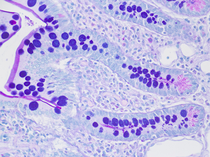 Alcian Blue/PAS Stained Histology Slide