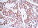 GCDFP-15 Stained Histology Slide