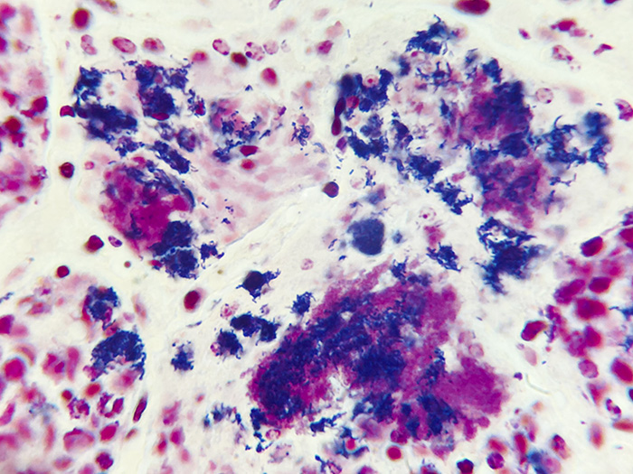 Gram Positive & Gram Negative Bacteria, Animal Stained Histology Slide