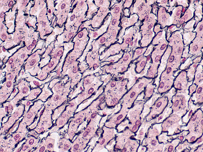 Reticulum Stained Histology Slide