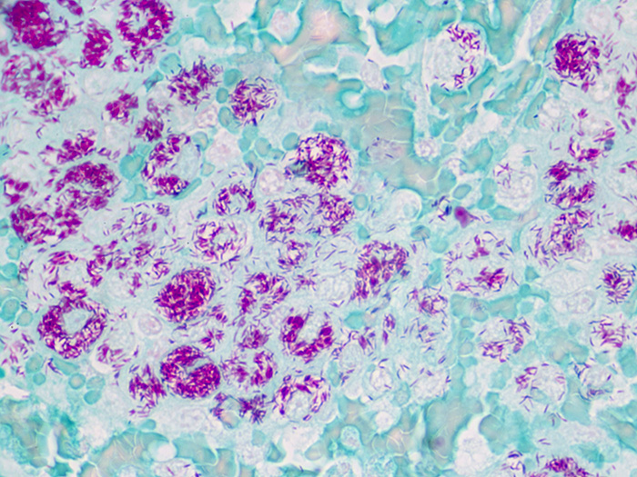 Fite, Leprosy, Animal Stained Histology Slide