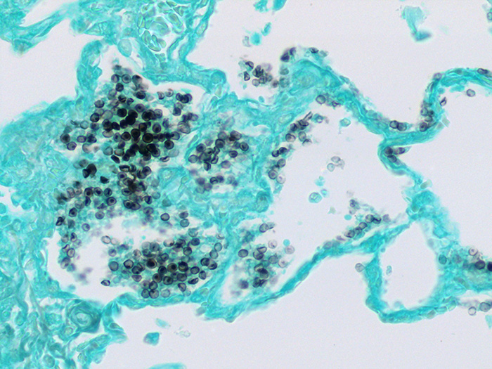 Pneumocystis sp., Animal Stained Histology Slide