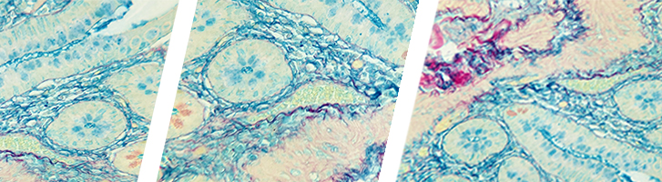 Colloidal Iron, Muller-Mowry Stain Kit
