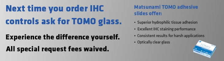 IHC controls on TOMO glass