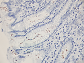 Helicobacter Histology Slides