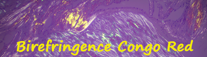 Amyloid Control Slides