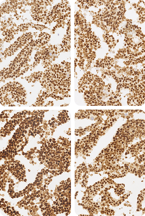 MMR-A Cell Line Blocks from HistoCyte